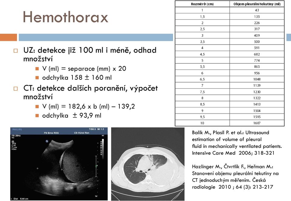 : Ultrasound estimation of volume of pleural fluid in mechanically ventilated patients.