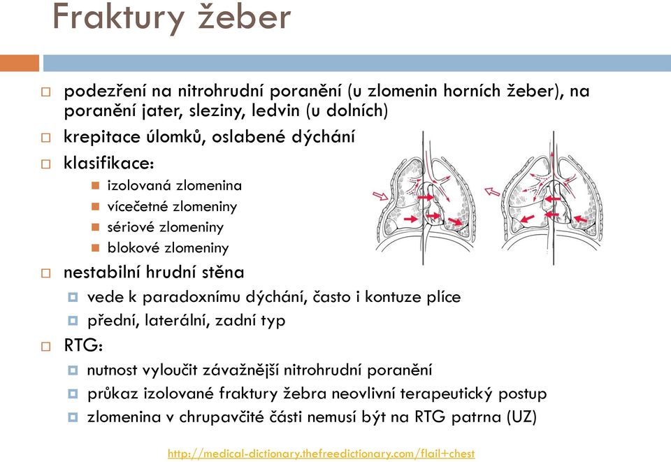 paradoxnímu dýchání, často i kontuze plíce přední, laterální, zadní typ RTG: nutnost vyloučit závažnější nitrohrudní poranění průkaz izolované