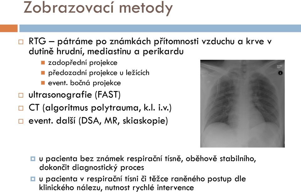 bočná projekce ultrasonografie (FAST) CT (algoritmus polytrauma, k.l. i.v.) event.