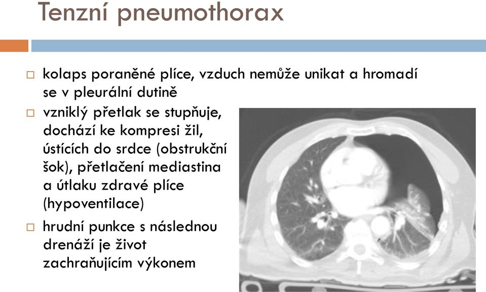 ústících do srdce (obstrukční šok), přetlačení mediastina a útlaku zdravé