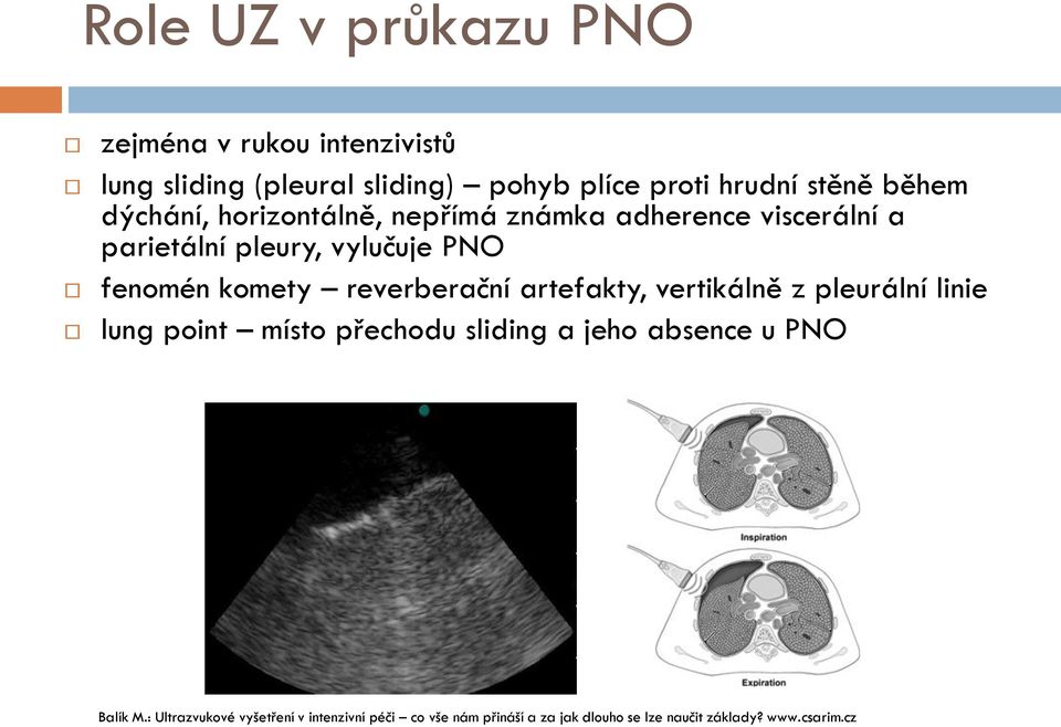 reverberační artefakty, vertikálně z pleurální linie lung point místo přechodu sliding a jeho absence u PNO Balík