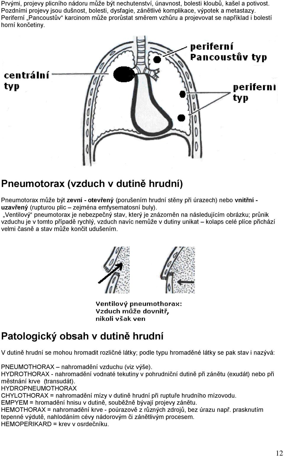 Pneumotorax (vzduch v dutině hrudní) Pneumotorax můţe být zevní - otevřený (porušením hrudní stěny při úrazech) nebo vnitřní - uzavřený (rupturou plic zejména emfysematosní buly).