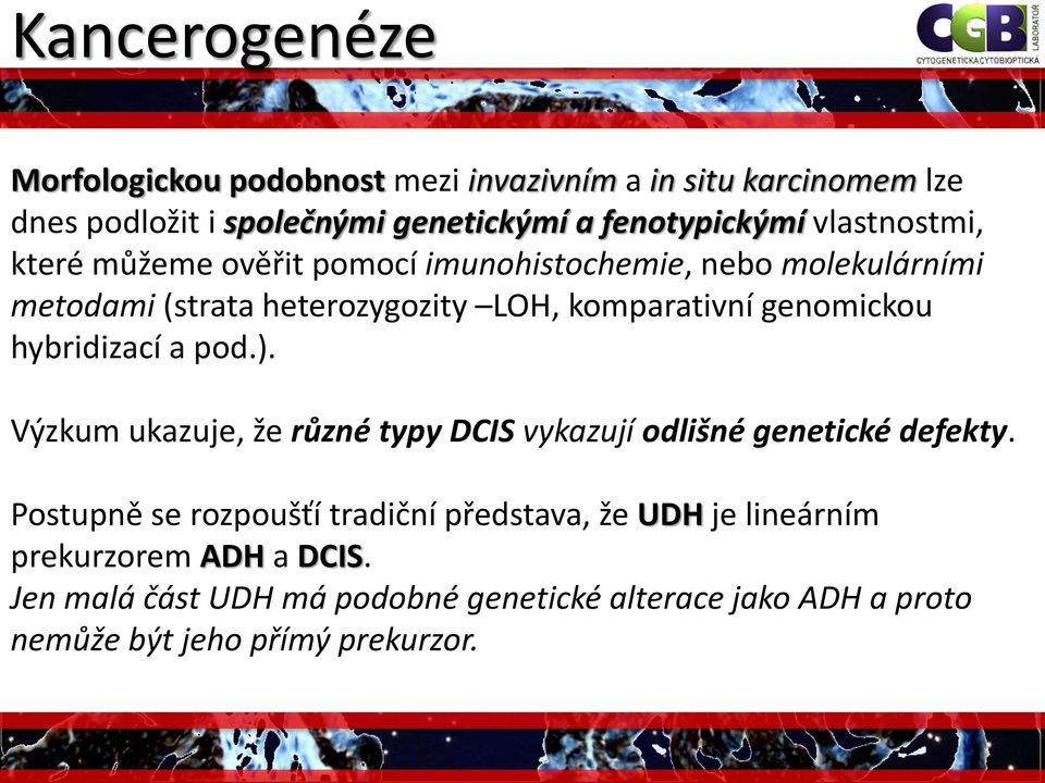 loss 16q Postupně se rozpoušťí tradiční představa, že UDH je lineárním prekurzorem ADH a DCIS. Jen malá část UDH má podobné genetické alterace jako ADH a proto nemůže být jeho přímý prekurzor.