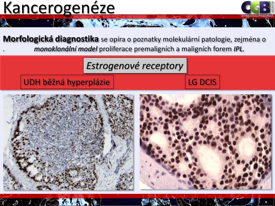 monoklonální model proliferace premaligních a