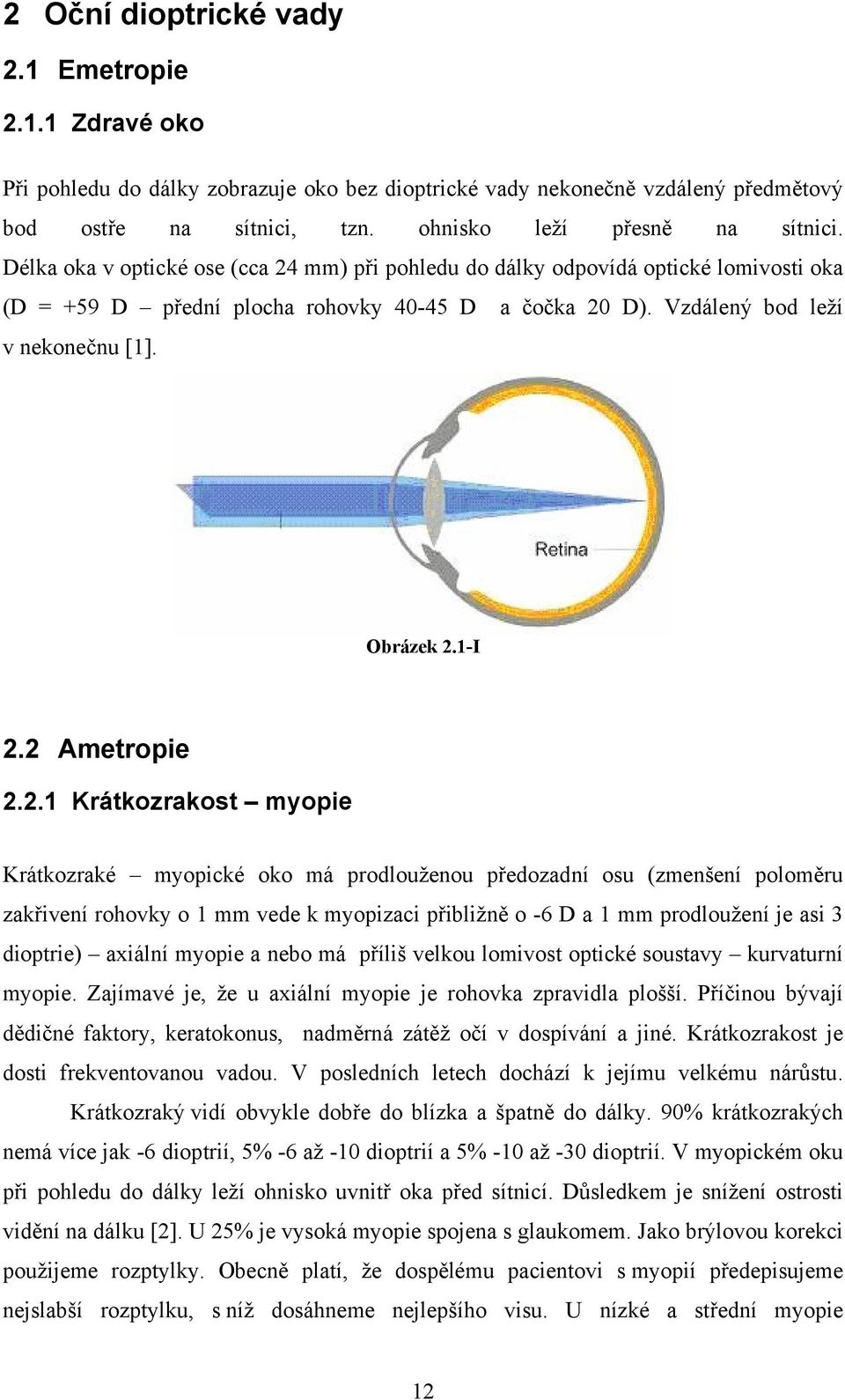 2 Ametropie 2.2.1 Krátkozrakost myopie Krátkozraké myopické oko má prodlouženou předozadní osu (zmenšení poloměru zakřivení rohovky o 1 mm vede k myopizaci přibližně o -6 D a 1 mm prodloužení je asi