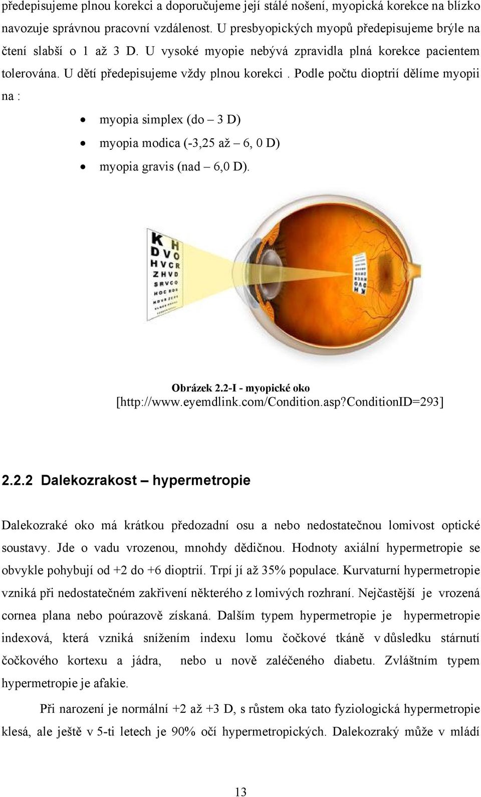 Podle počtu dioptrií dělíme myopii na : myopia simplex (do 3 D) myopia modica (-3,25 až 6, 0 D) myopia gravis (nad 6,0 D). Obrázek 2.2-I - myopické oko [http://www.eyemdlink.com/condition.asp?