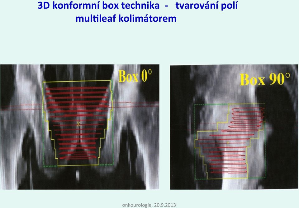 tvarování polí