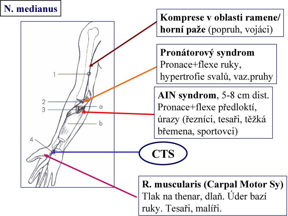 Pronace+flexe předloktí, úrazy (řezníci, tesaři, těžká břemena, sportovci) CTS R.