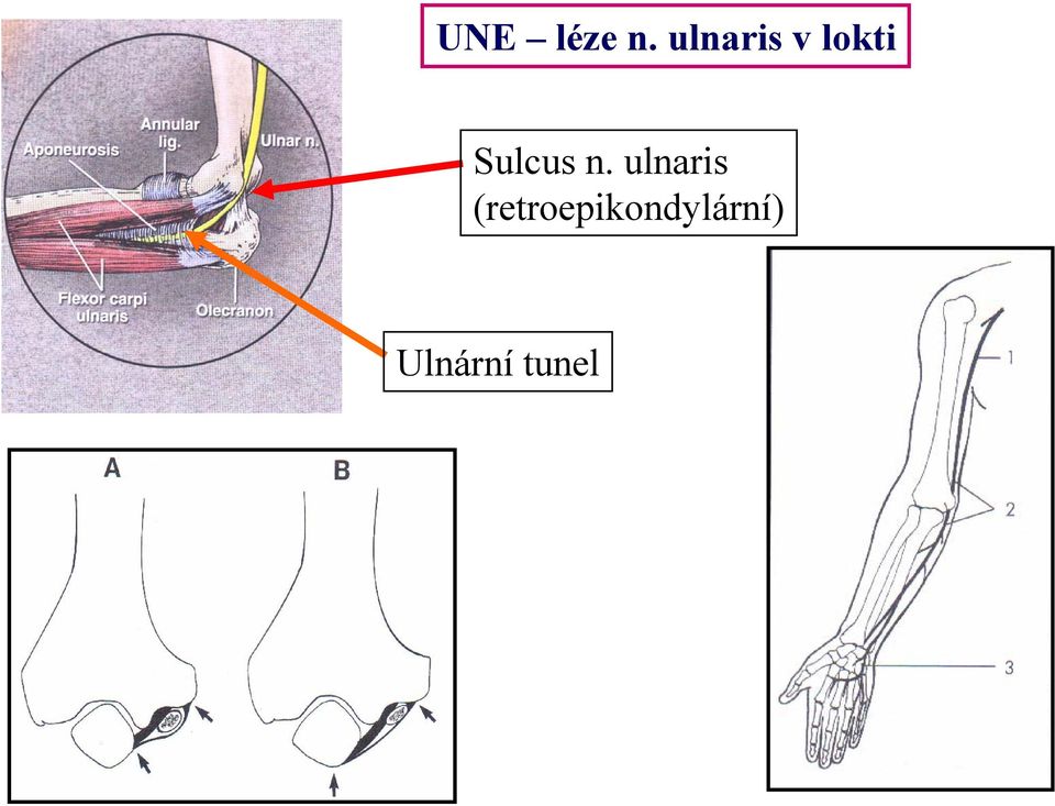 Sulcus n.