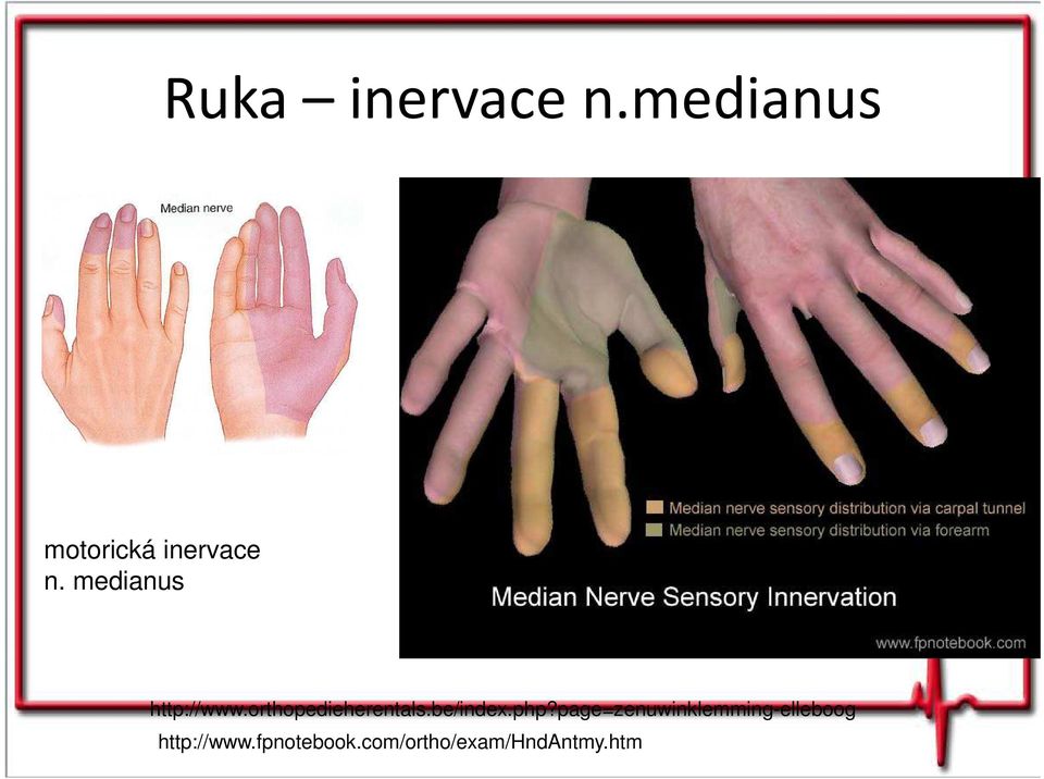 medianus http://www.orthopedieherentals.