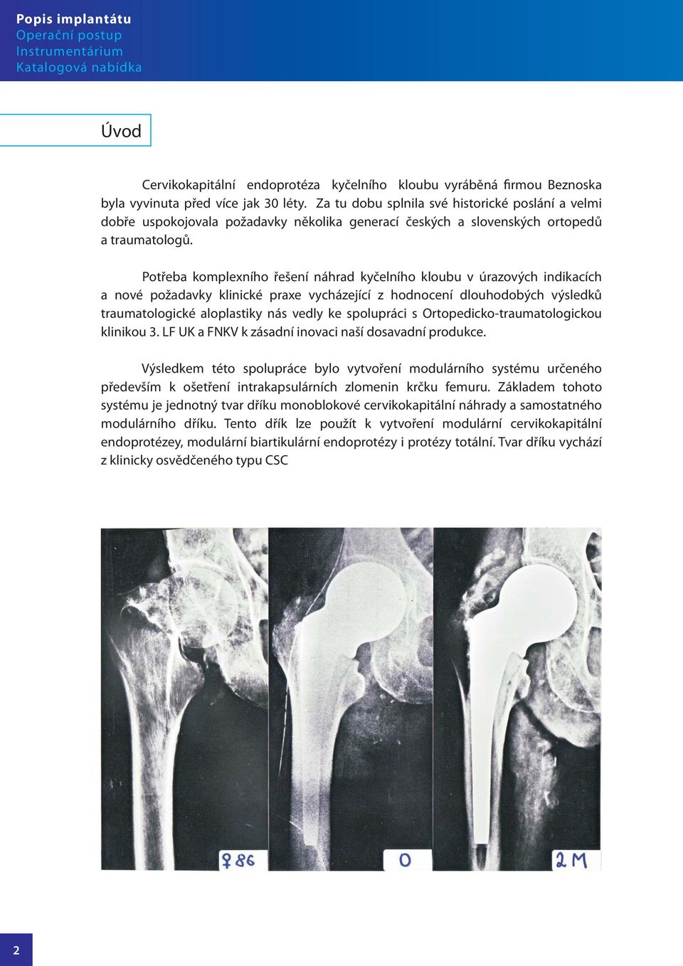 Potřeba komplexního řešení náhrad kyčelního kloubu v úrazových indikacích a nové požadavky klinické praxe vycházející z hodnocení dlouhodobých výsledků traumatologické aloplastiky nás vedly ke