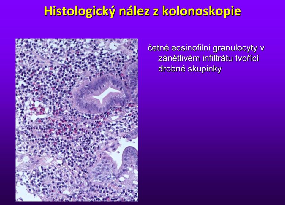 eosinofilní granulocyty v