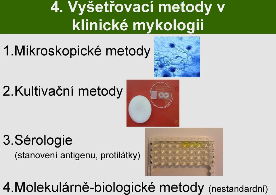 Sérologie (stanovení antigenu, protilátky) 4.