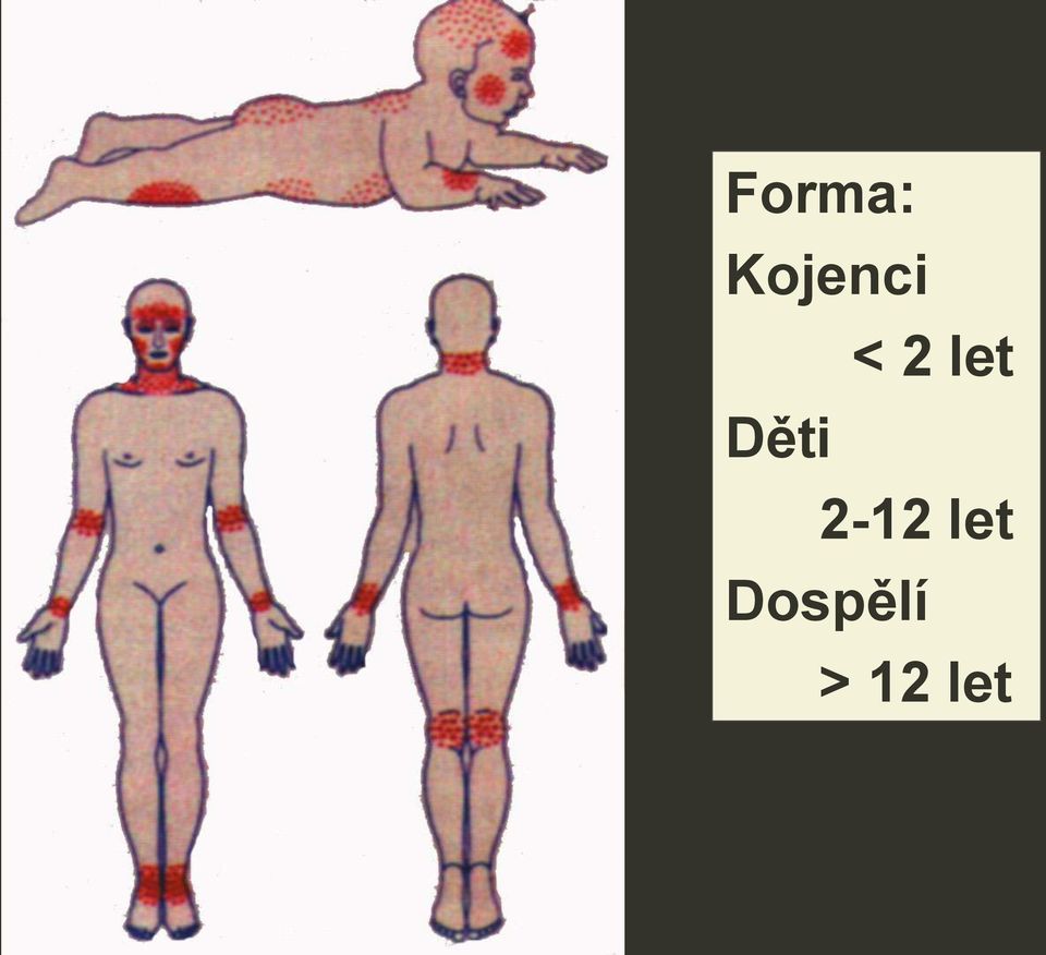 let Děti 2-12