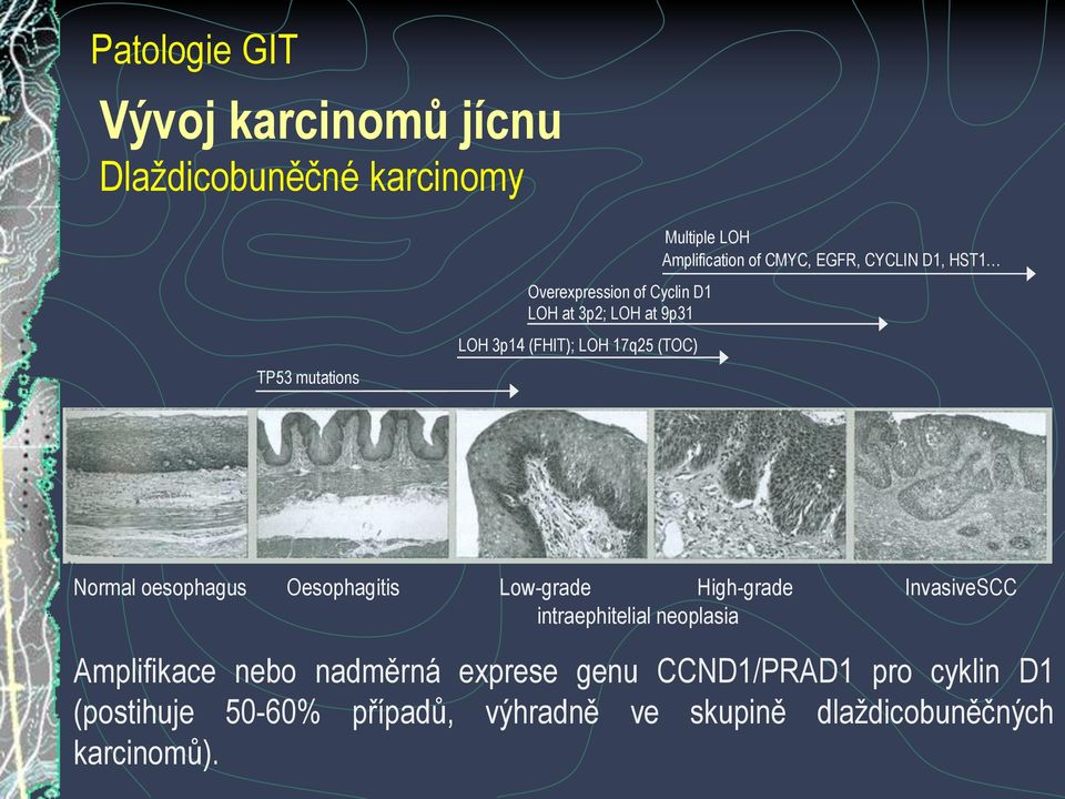 oesophagus Oesophagitis Low-grade High-grade InvasiveSCC intraephitelial neoplasia Amplifikace nebo nadměrná