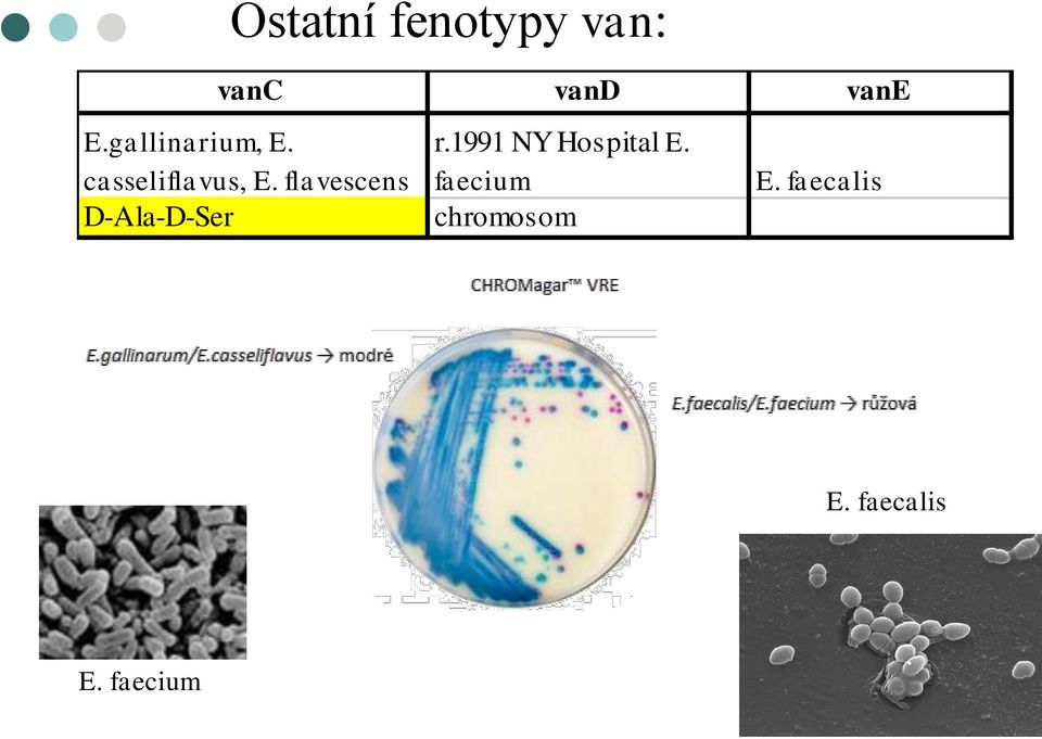 flavescens r.1991 NY Hospital E. faecium E.