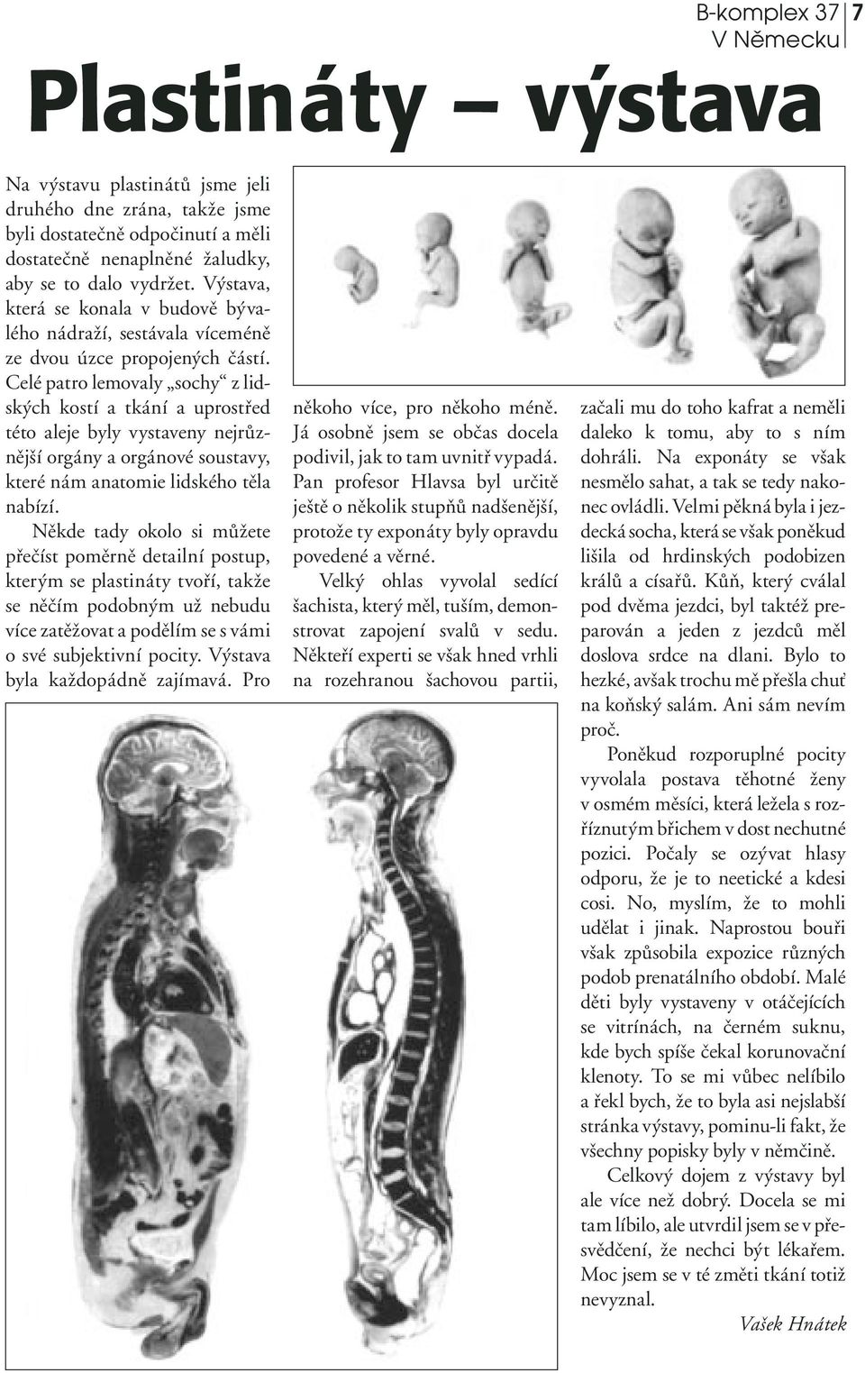 Celé patro lemovaly sochy z lidských kostí a tkání a uprostřed této aleje byly vystaveny nejrůznější orgány a orgánové soustavy, které nám anatomie lidského těla nabízí.