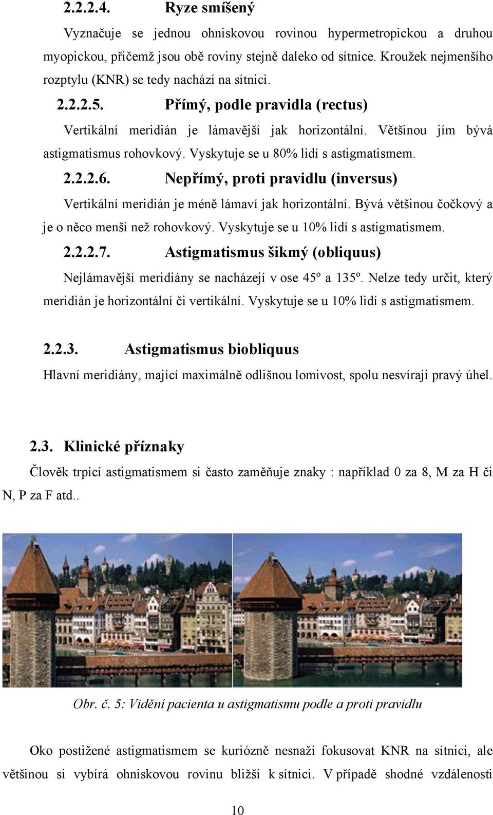 Vyskytuje se u 80% lidí s astigmatismem. 2.2.2.6. Nepřímý, proti pravidlu (inversus) Vertikální meridián je méně lámaví jak horizontální. Bývá většinou čočkový a je o něco menší než rohovkový.