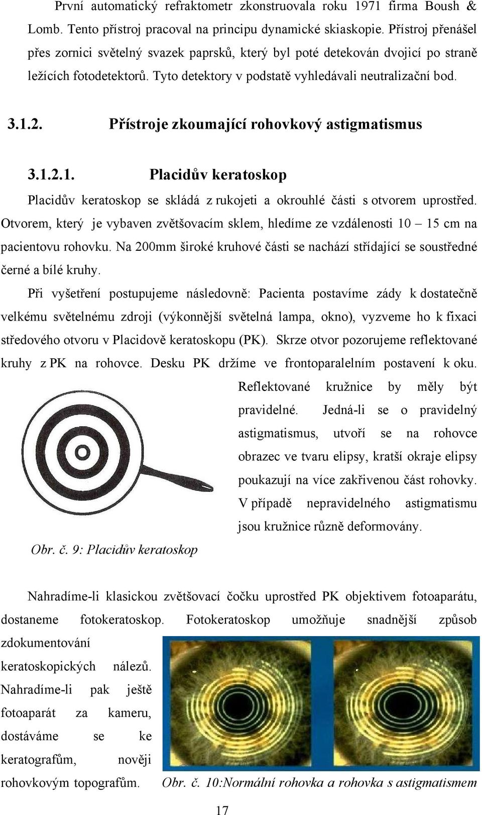 Přístroje zkoumající rohovkový astigmatismus 3.1.2.1. Placidův keratoskop Placidův keratoskop se skládá z rukojeti a okrouhlé části s otvorem uprostřed.