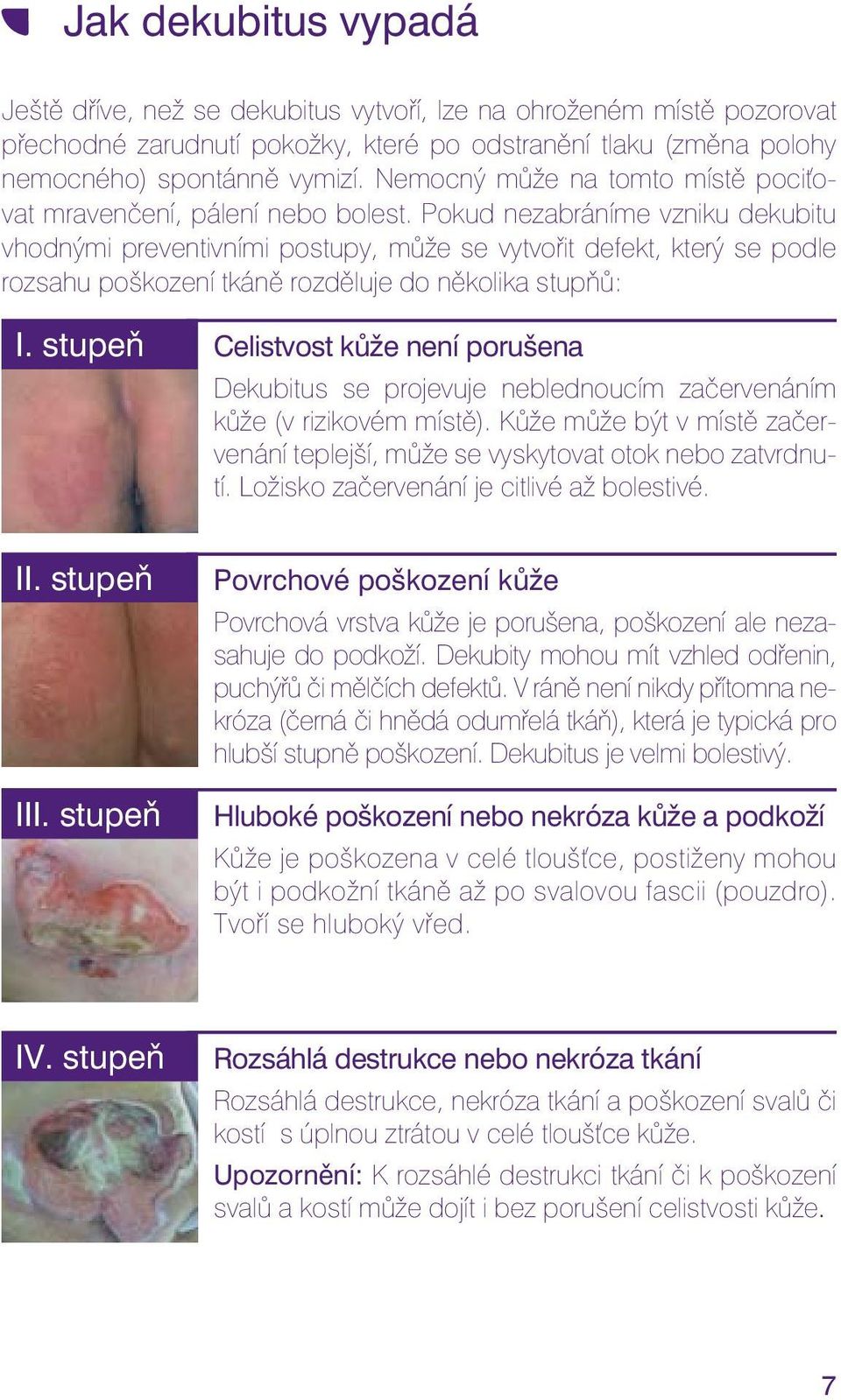 Pokud nezabráníme vzniku dekubitu vhodnými preventivními postupy, může se vytvořit defekt, který se podle rozsahu poškození tkáně rozděluje do několika stupňů: I.