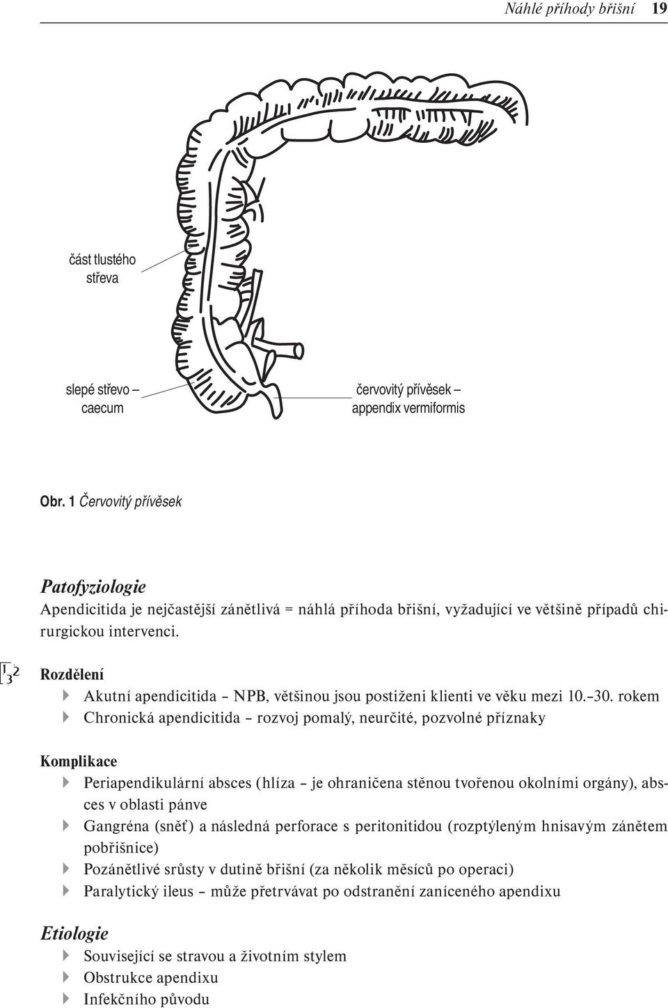 1 2 3 Rozdělení Akutní apendicitida NPB, většinou jsou postiženi klienti ve věku mezi 10. 30.