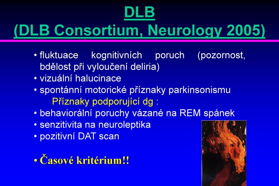 motorické příznaky parkinsonismu Příznaky podporující dg : behaviorální