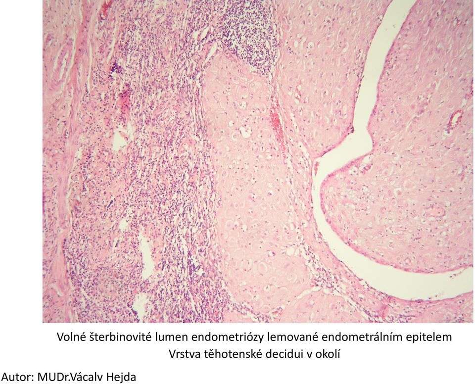 endometrálním epitelem Vrstva