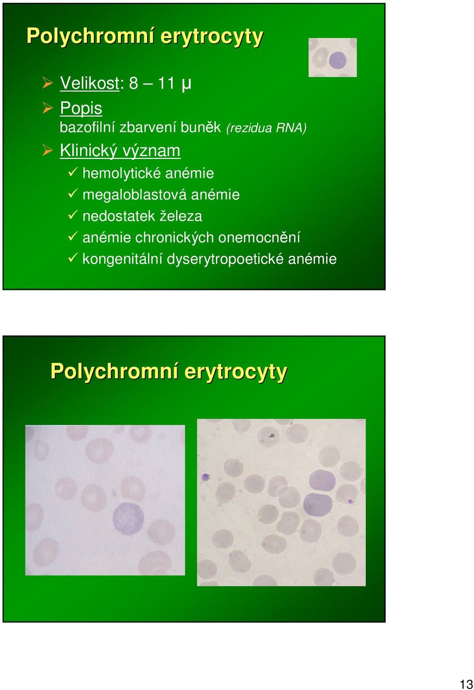 anémie nedostatek železa anémie chronických onemocnní