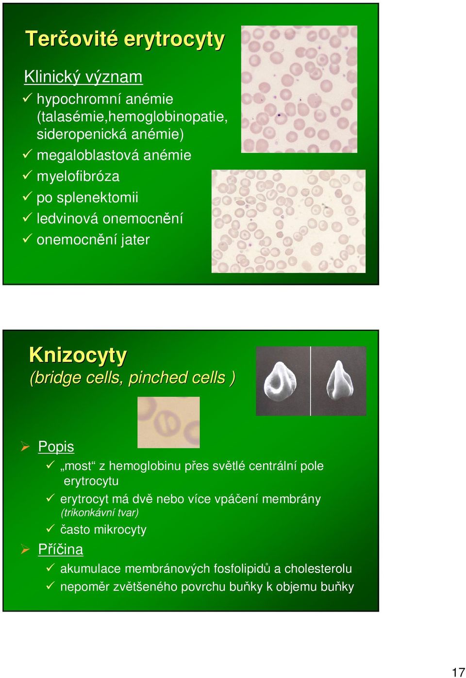 ) most z hemoglobinu pes svtlé centrální pole erytrocytu erytrocyt má dv nebo více vpáení membrány