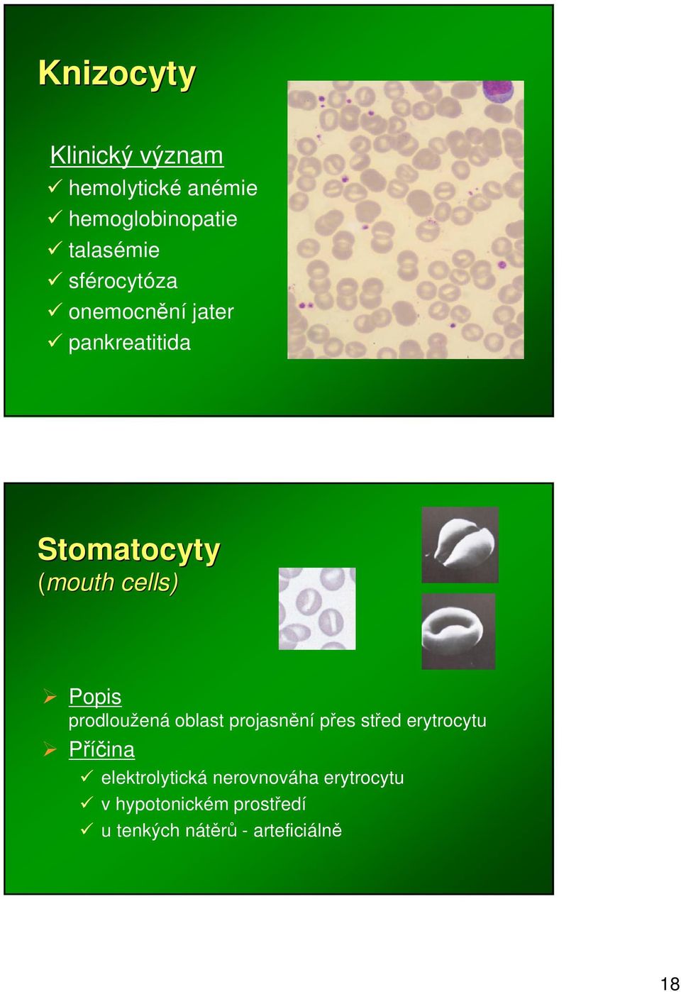 cells) prodloužená oblast projasnní pes sted erytrocytu