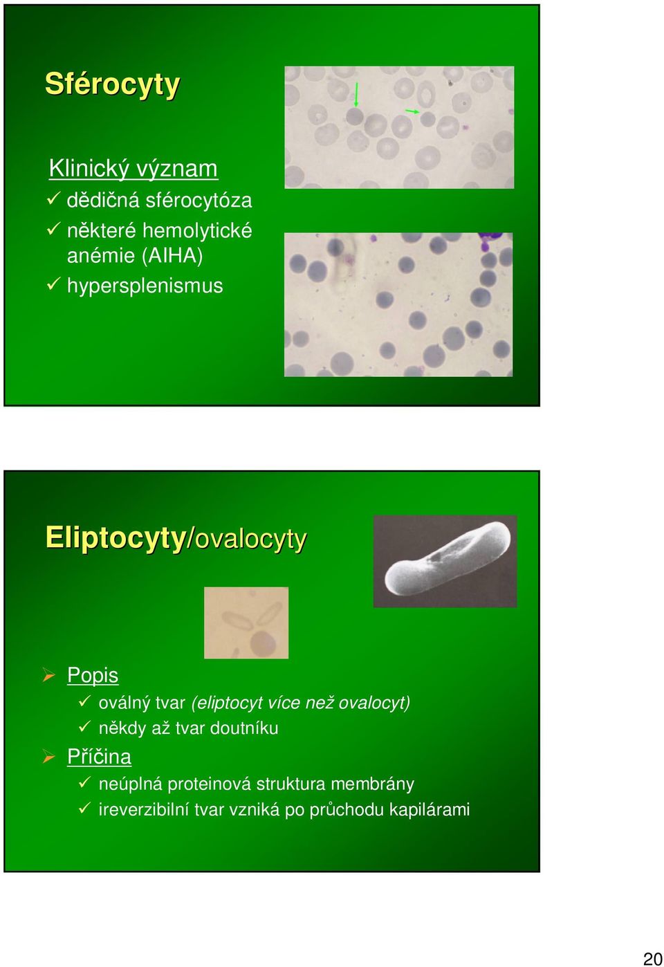 (eliptocyt více než ovalocyt) nkdy až tvar doutníku neúplná