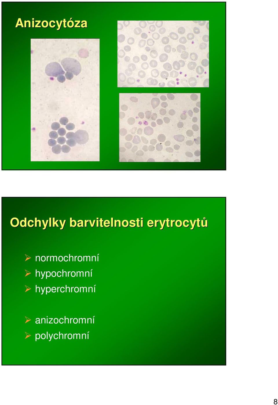 normochromní hypochromní