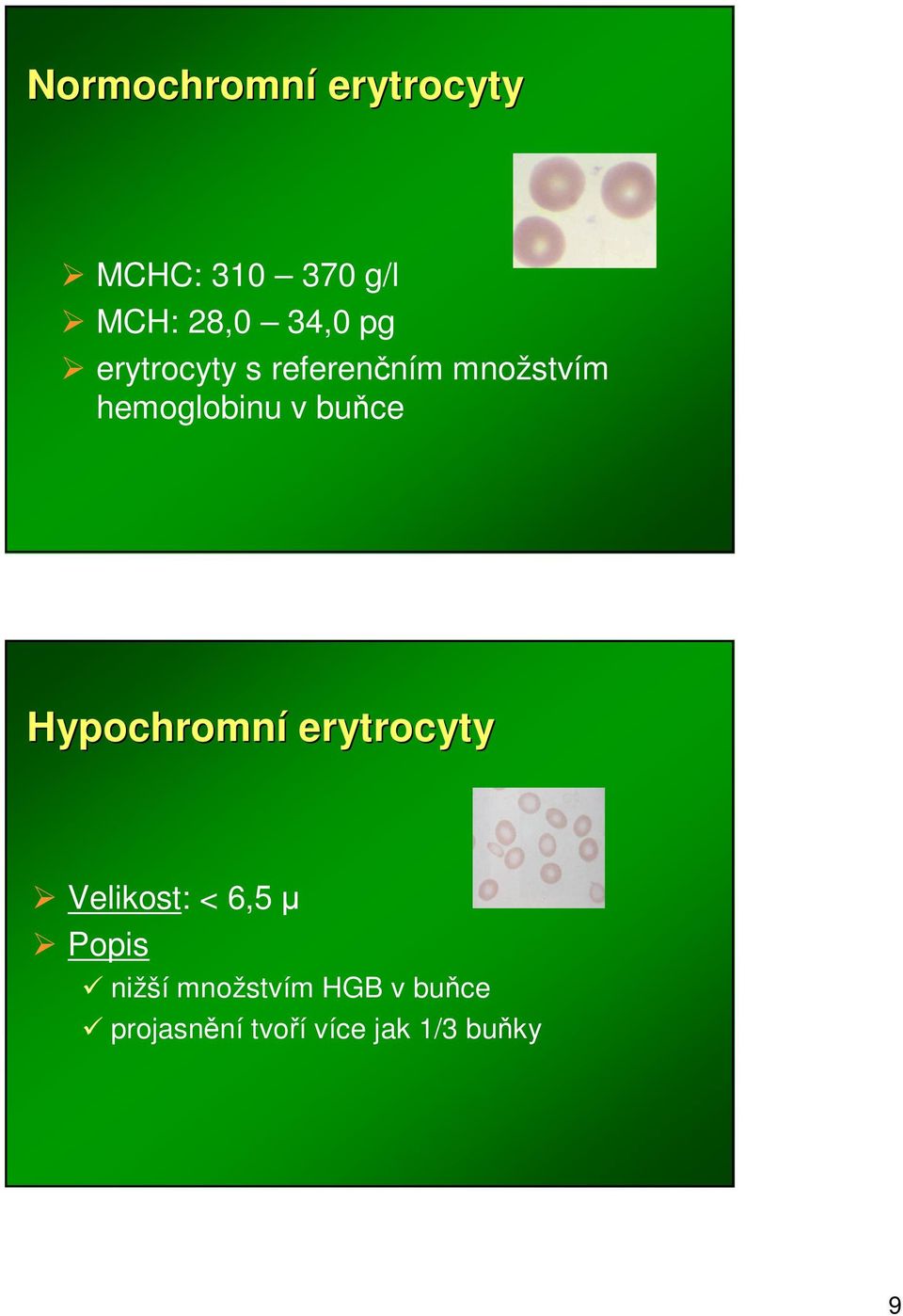 v buce Hypochromní erytrocyty Velikost: < 6,5 nižší