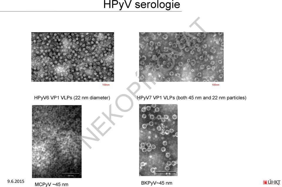 VP1 VLPs (both 45 nm and 22 nm