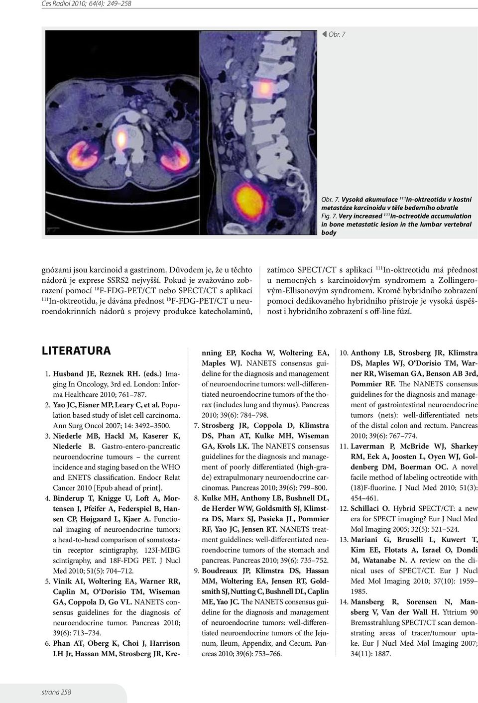 Pokud je zvažováno zobrazení pomocí 18 F-FDG-PET/CT nebo SPECT/CT s aplikací In-oktreotidu, je dávána přednost 18 F-FDG-PET/CT u neuroendokrinních nádorů s projevy produkce katecholaminů, zatímco