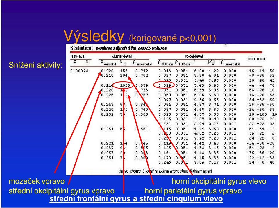 střední okcipitální gyrus vpravo horní parietální