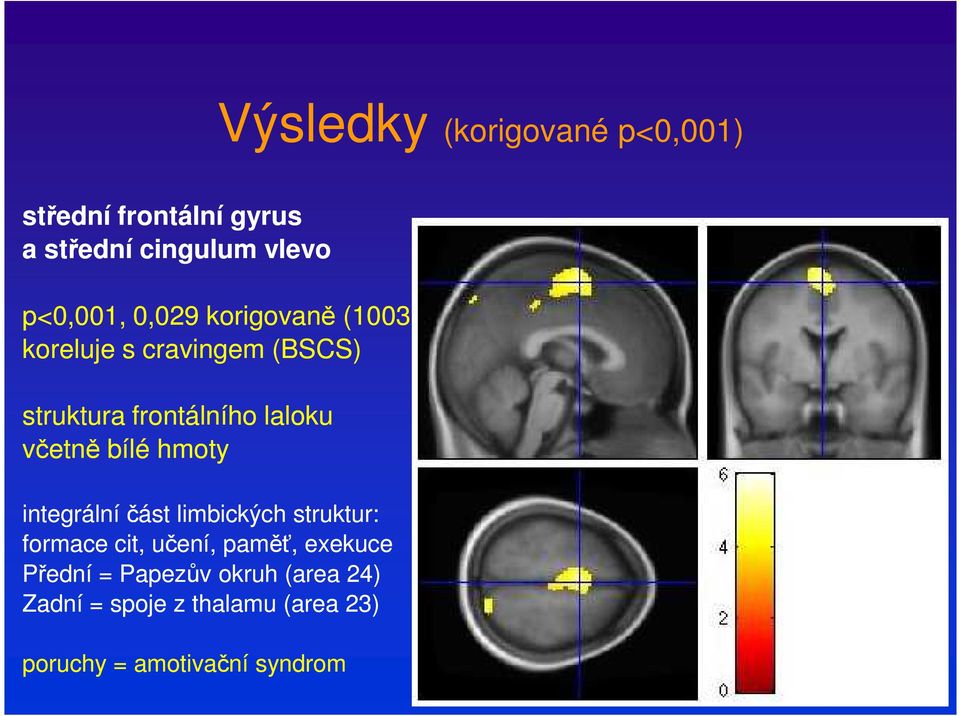 bílé hmoty integrální část limbických struktur: formace cit, učení, paměť, exekuce