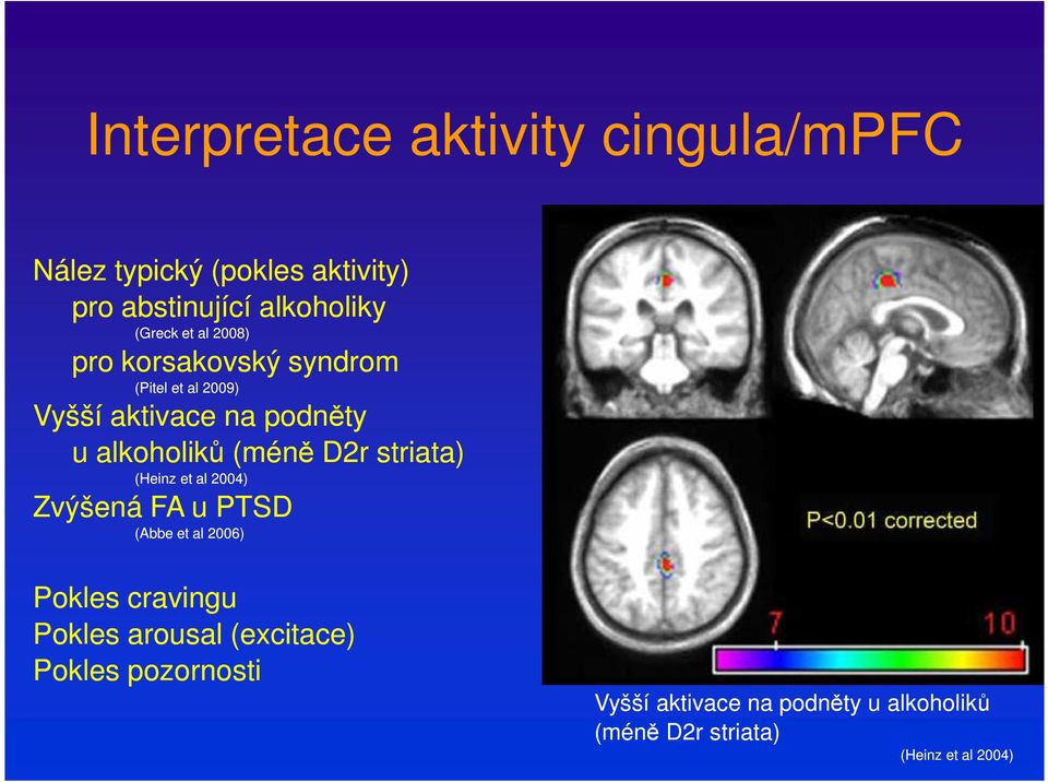2r striata) (Heinz et al 2004) Zvýšená FA u PTS (Abbe et al 2006) Pokles cravingu Pokles arousal
