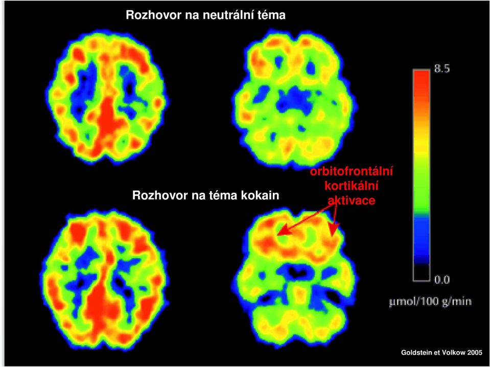 orbitofrontální kortikální