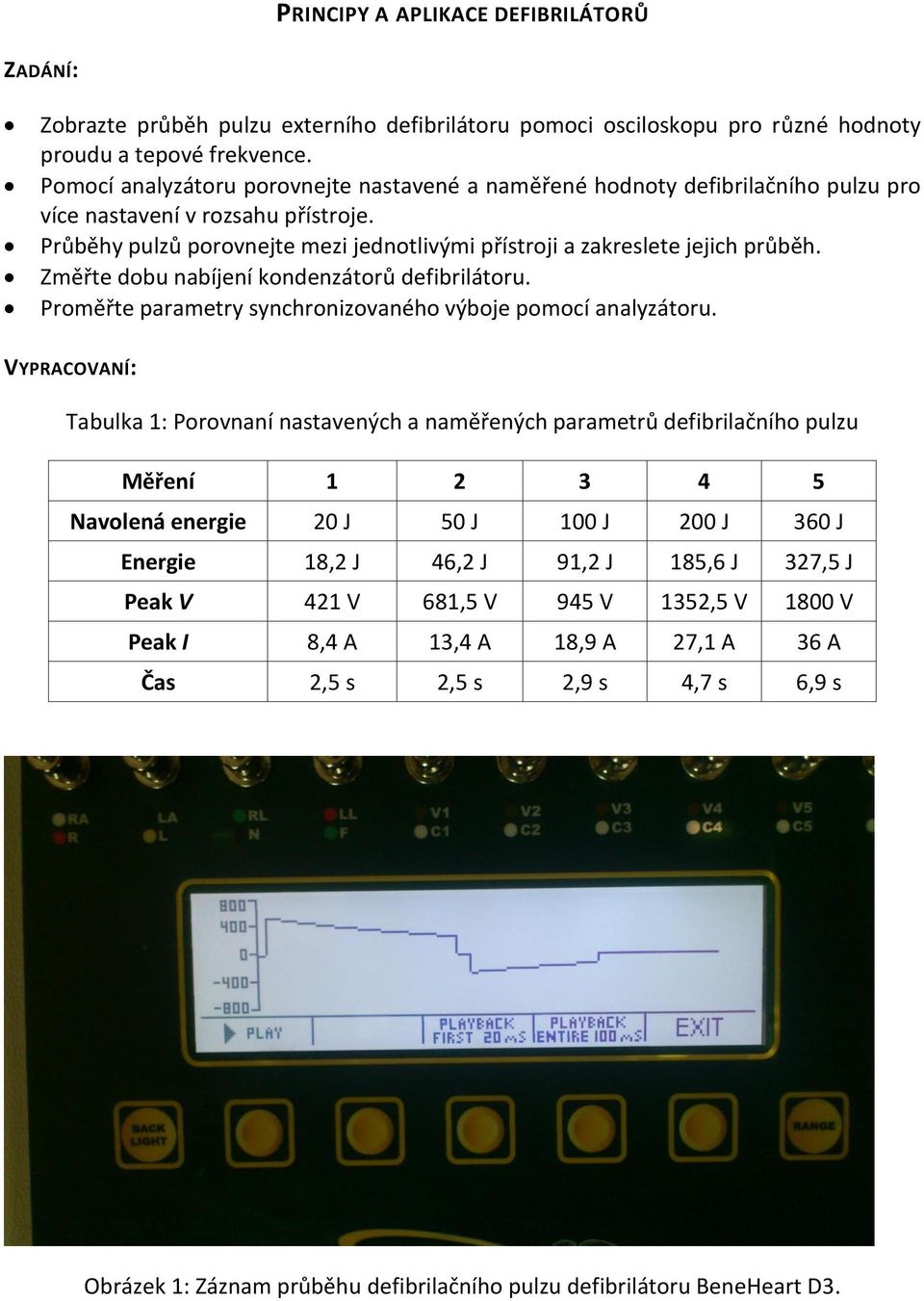 Změřte dobu nabíjení kondenzátorů defibrilátoru. Proměřte parametry synchronizovaného výboje pomocí analyzátoru.