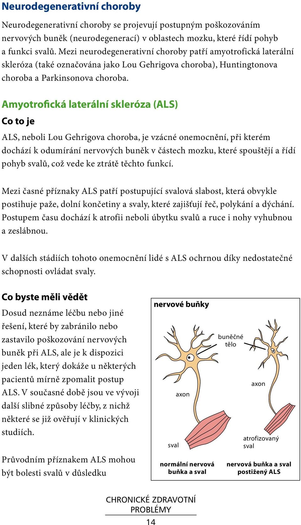 Amyotrofická laterální skleróza (ALS) Co to je ALS, neboli Lou Gehrigova choroba, je vzácné onemocnění, při kterém dochází k odumírání nervových buněk v částech mozku, které spouštějí a řídí pohyb