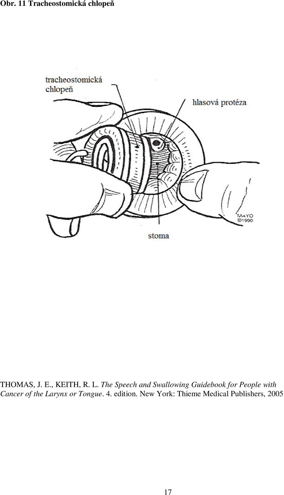 The Speech and Swallowing Guidebook for People