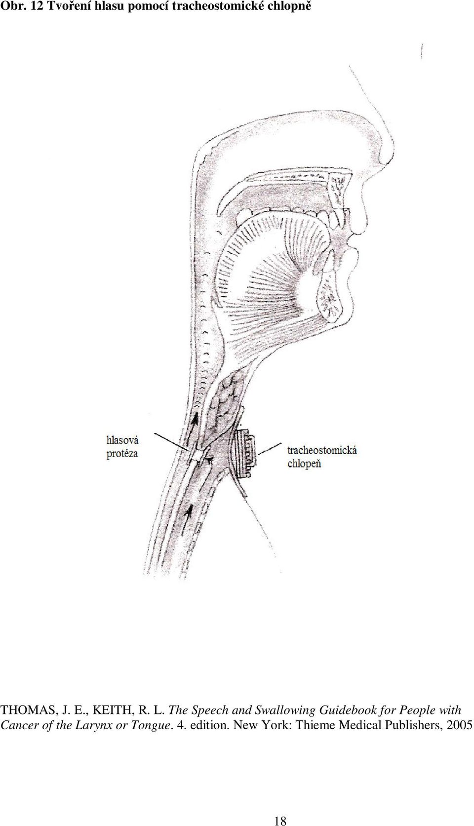 The Speech and Swallowing Guidebook for People with