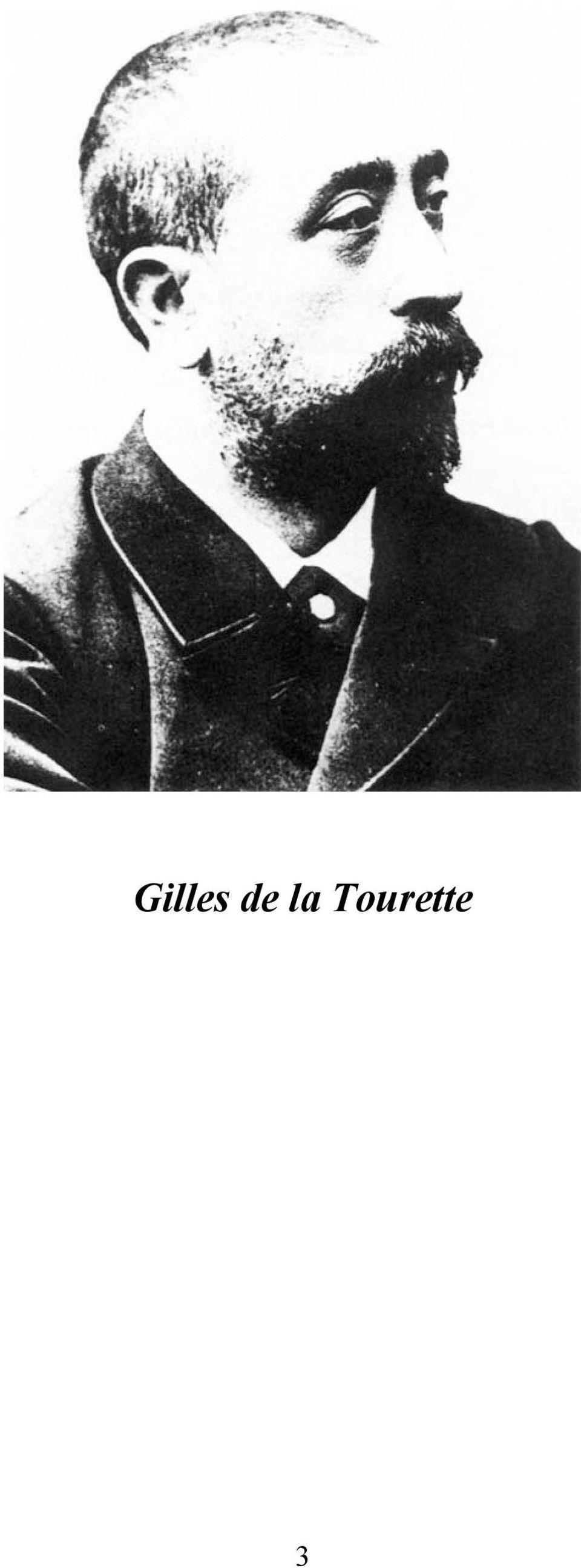 Tourette