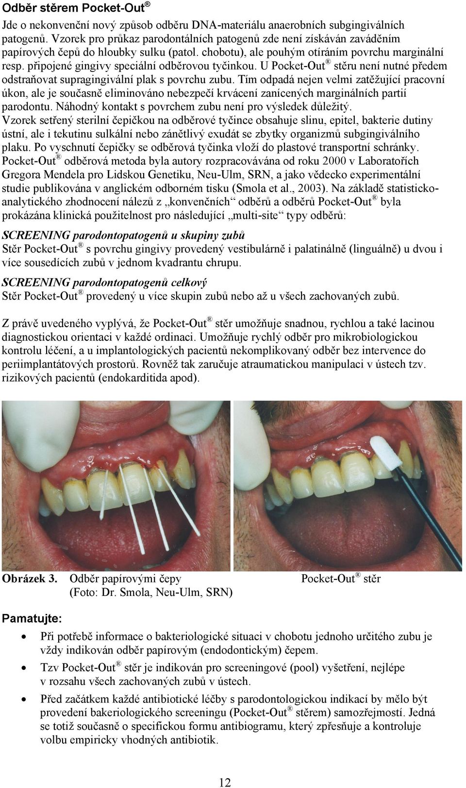 připojené gingivy speciální odběrovou tyčinkou. U PocketOut stěru není nutné předem odstraňovat supragingivální plak s povrchu zubu.