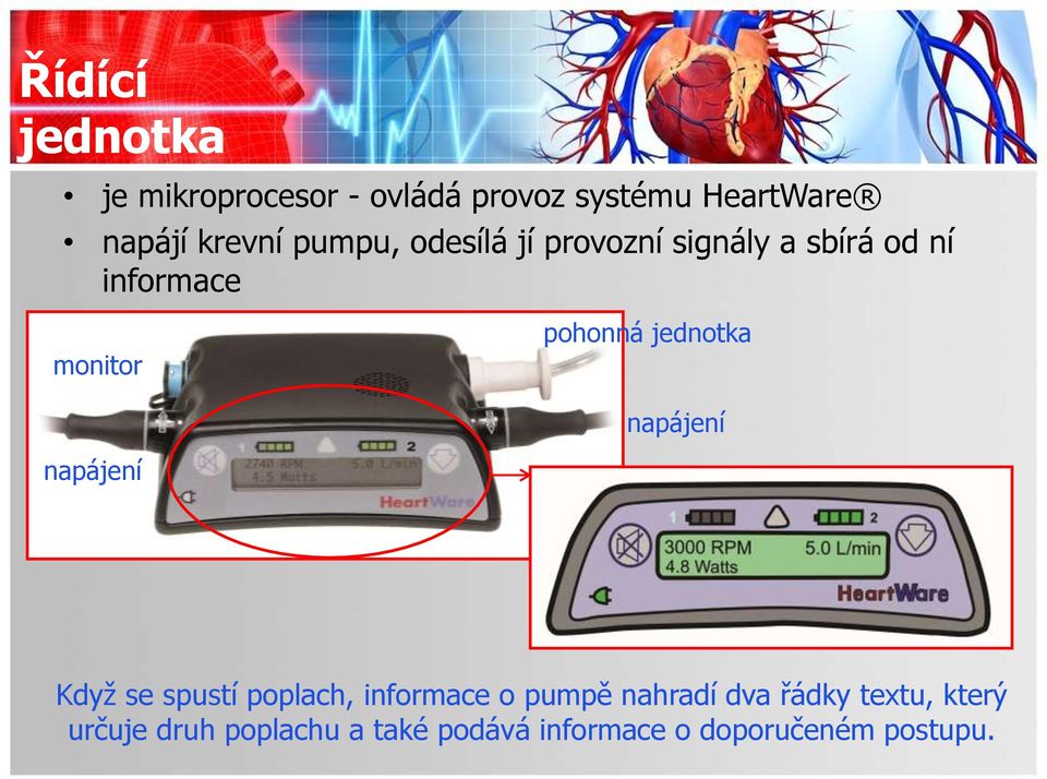 jednotka napájení napájení Když se spustí poplach, informace o pumpě nahradí dva