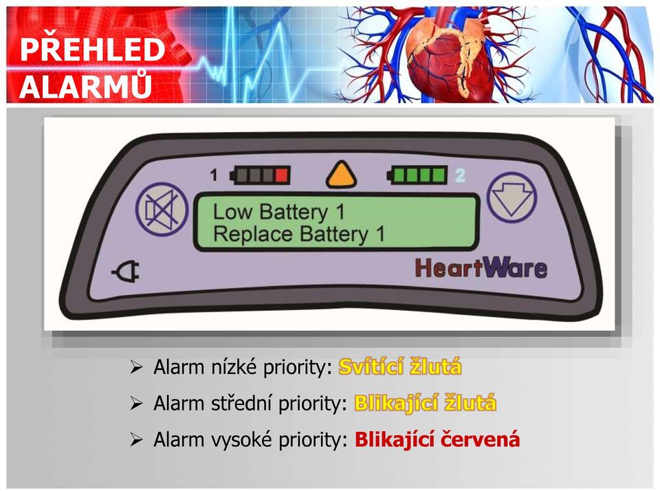 střední priority: Alarm