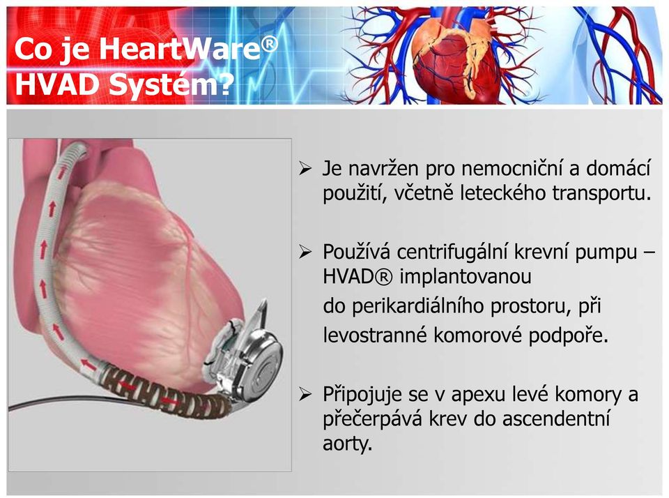 Používá centrifugální krevní pumpu HVAD implantovanou do perikardiálního