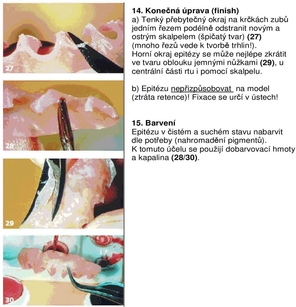 b) Epitézu nepřizpůsobovat na model (ztráta retence)! Fixace se určí v ústech! 15.
