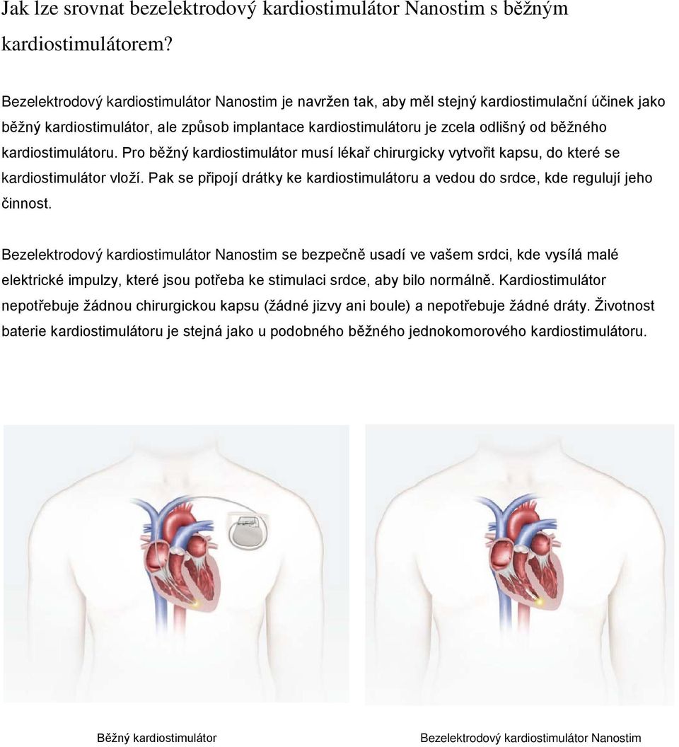 kardiostimulátoru. Pro běžný kardiostimulátor musí lékař chirurgicky vytvořit kapsu, do které se kardiostimulátor vloží.